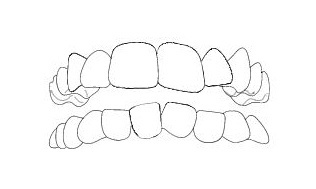 affollamento-dentale